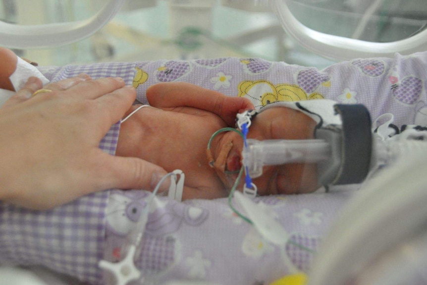 A premature baby lying in hospital.