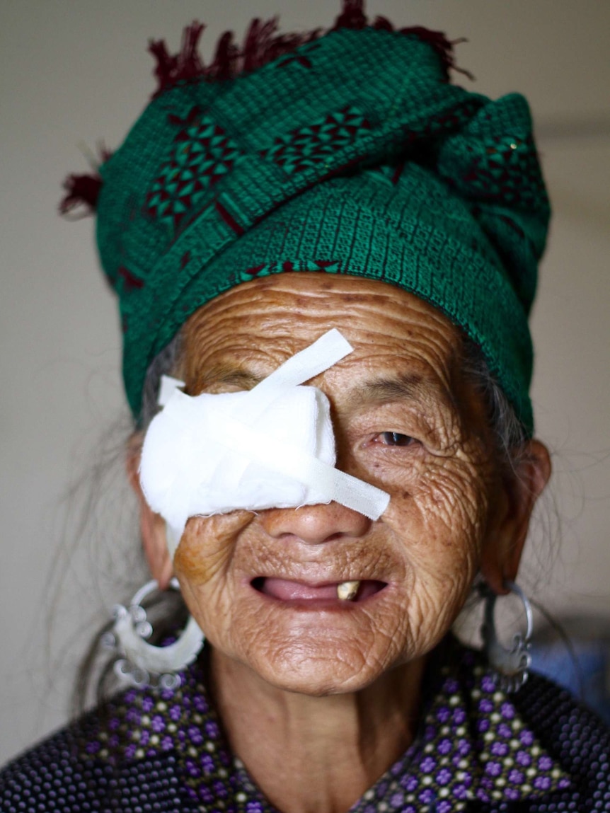 An old woman with colourful headscarf and patch over one eye smiling.