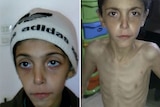 Syria starving children