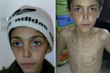 Syria starving children