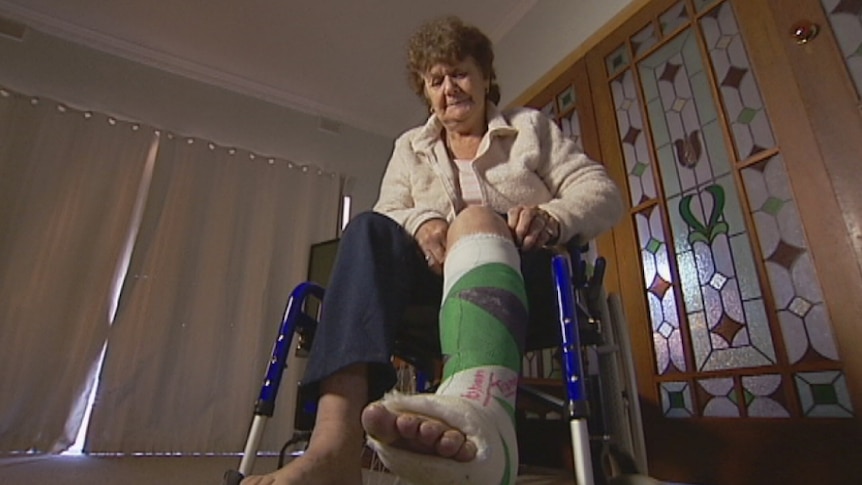 Marilyn Hicks with her broken leg