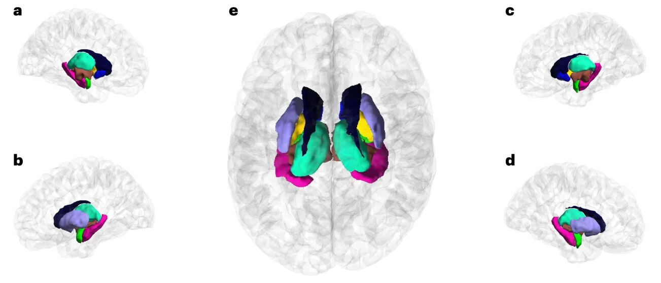 超貴重CD DNA「Scatter the brain」 超貴重CD DNA「Scatter the brain