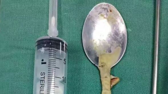 A grimy spoon covered in a film of mucous placed next to a syringe for scale. The spoon is roughly 20cm long.
