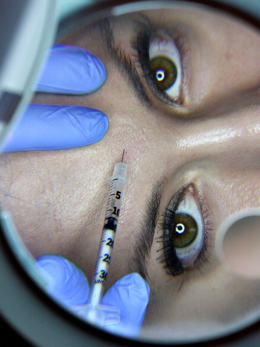 A woman has Botox injected into her forehead.