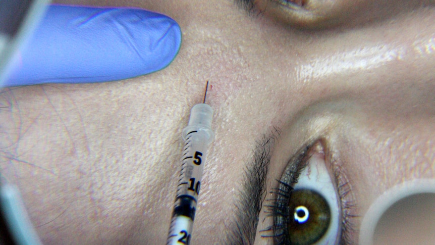 A woman has Botox injected into her forehead.