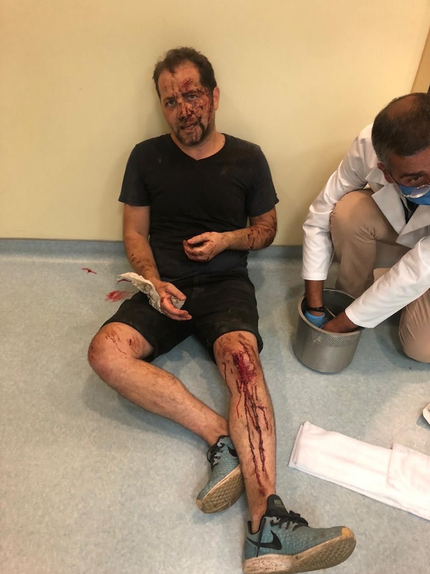 Omar covered in blood and bruises sitting against the wall on the floor while a doctor examines him