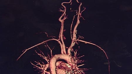 A heart imaging