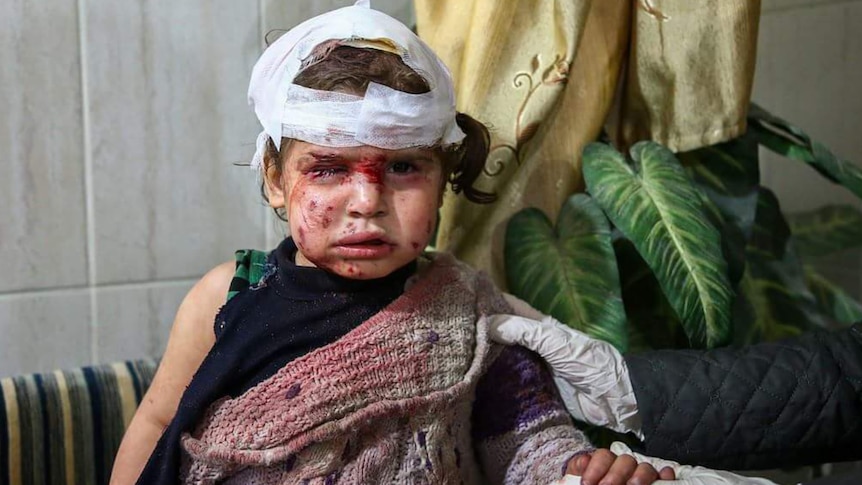A young girl with bandages covering much of her scalp, one eye is swollen shut, cuts on her face, blood on her face and clothes