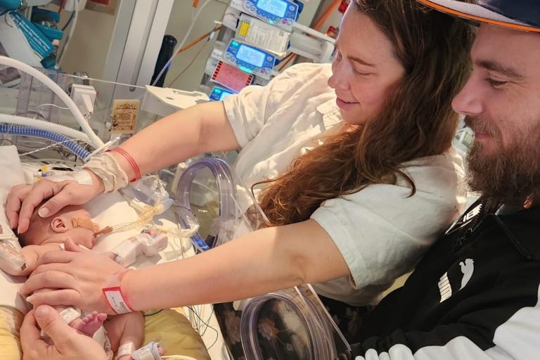 Baby Menasheh lays in the neonatal intensive care unit as his parents watch over him