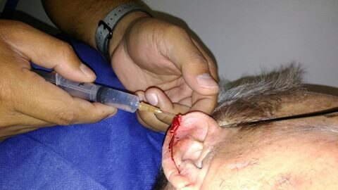 A doctor puts an injection into mans ear as he stitches up a wound
