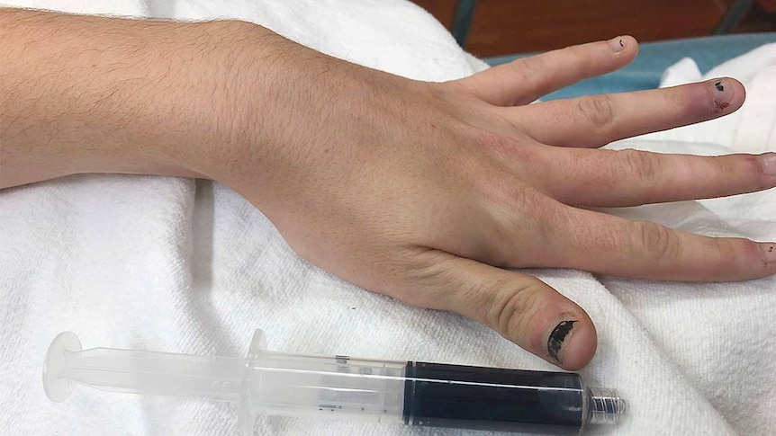 A woman's hand laying on a white towel next to a vial of a dark, blue liquid.