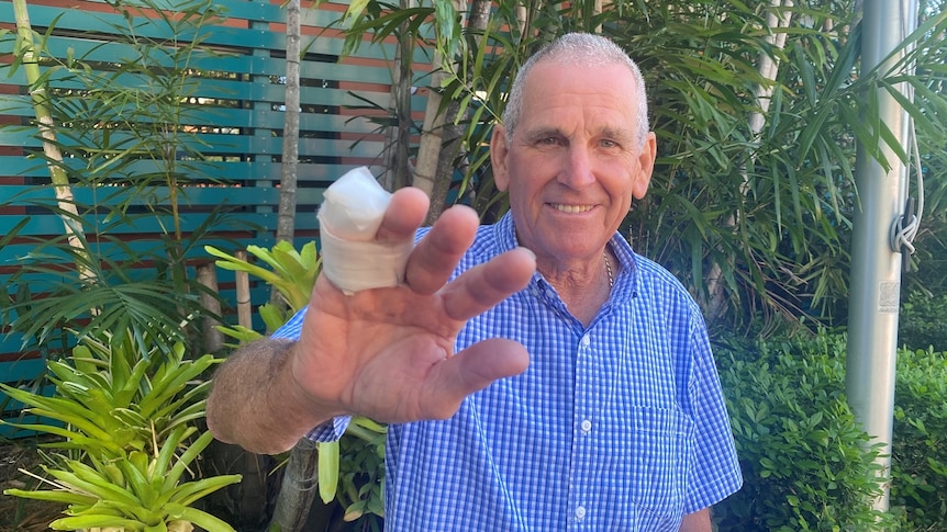 An elderly man smiles at the camera, holding a bandaged finger up, greenery behind.