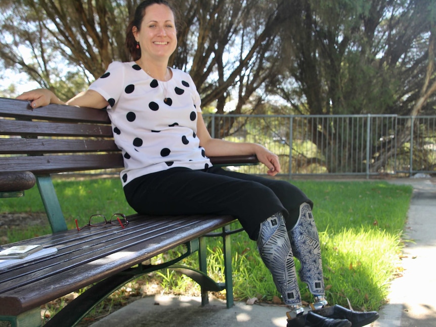 Lisa Burnette sits on a park bench smiling with her prosthetic legs visible below her knees.