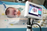 A baby with a breathing tube displayed on a screen attached to a cot