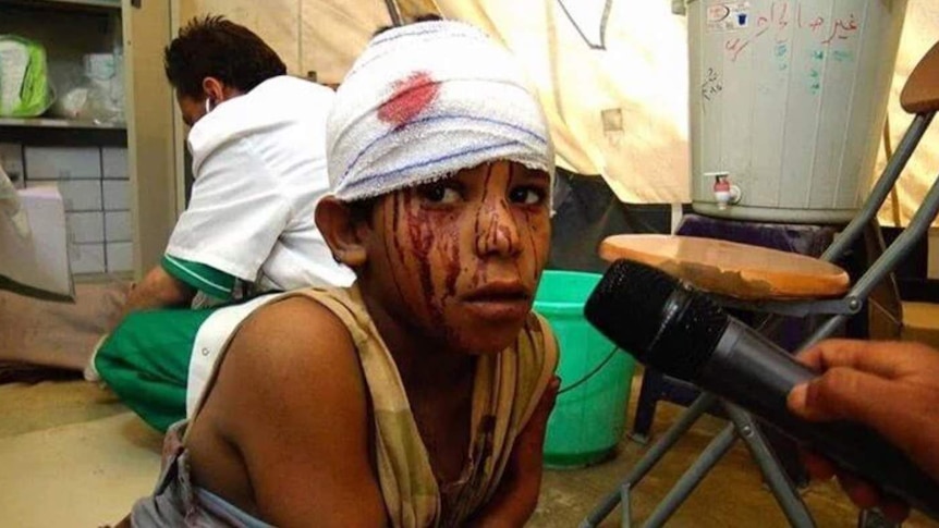 Child with bandage wrapped around his head and blood on his face