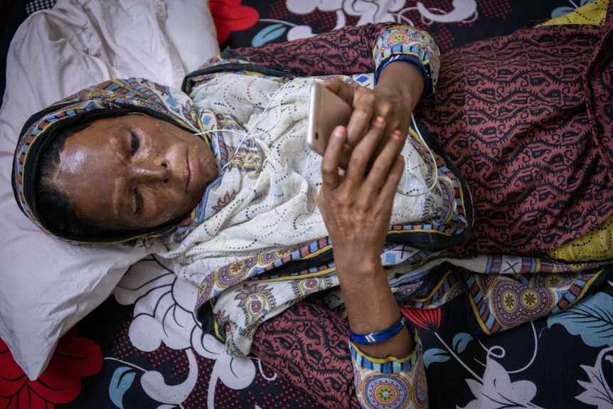 A woman with a scarred face lying on a bed looking at her phone