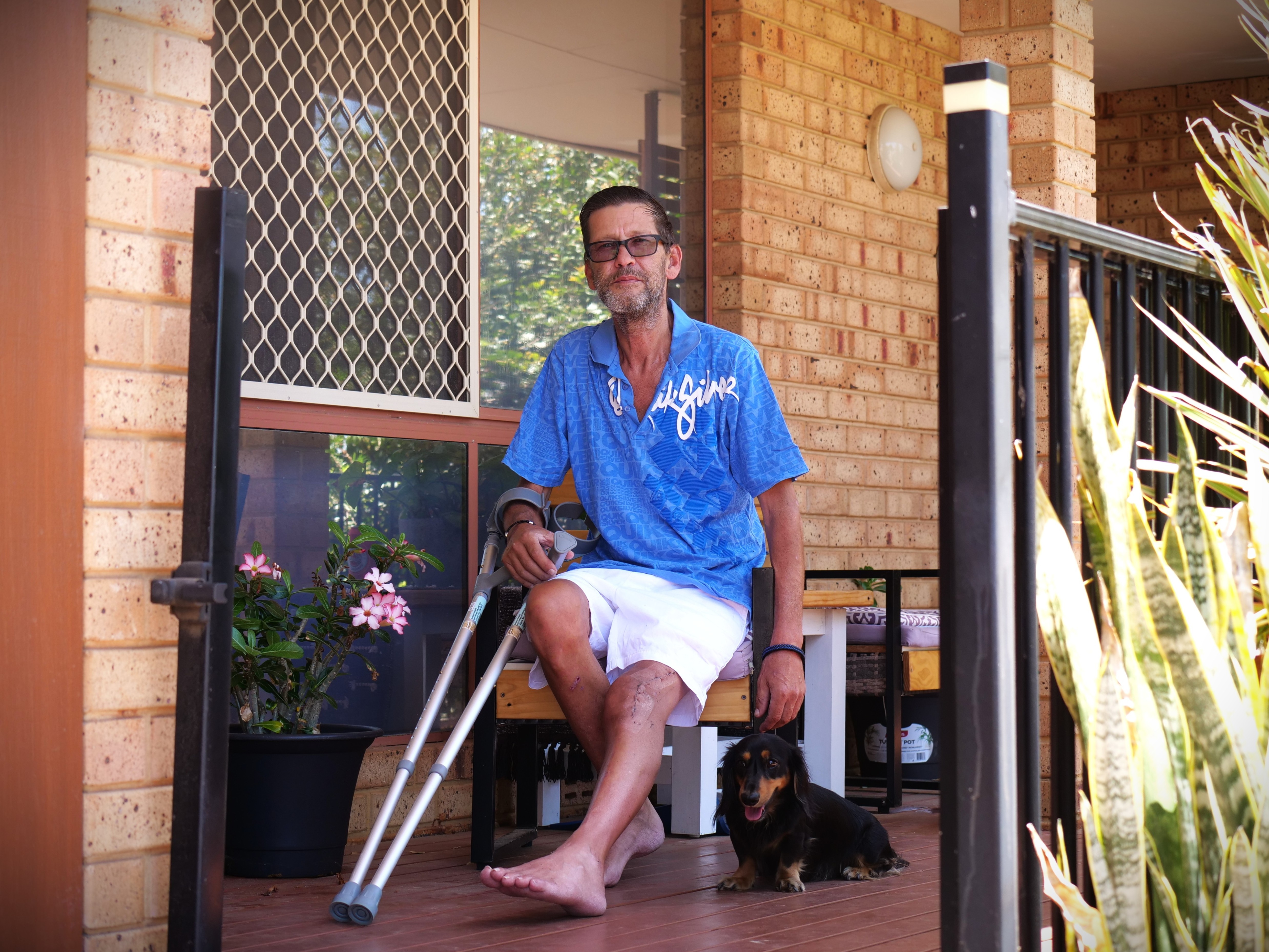 Stuart's accident on an e-scooter led him to warn others against them