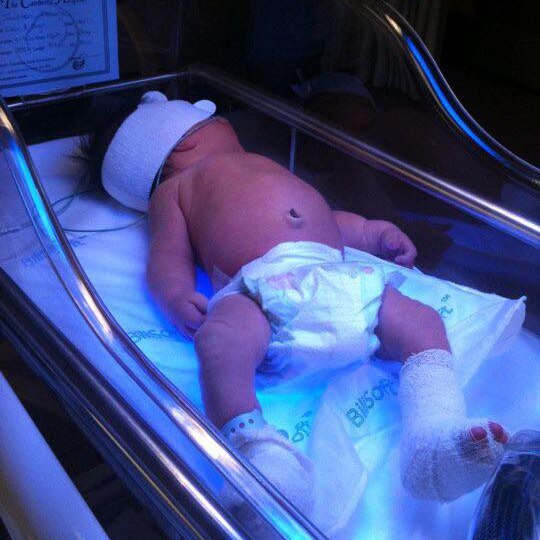 A baby in a cot with bandaged feet, legs and head.
