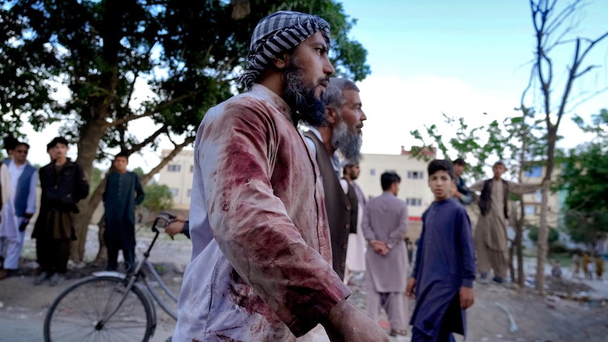 A man in blood-stained clothes walking.