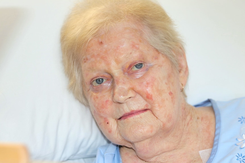 Aged care resident, Desley Helsham
