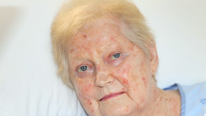 Aged care resident, Desley Helsham