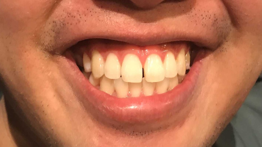 Close up of Dentist Chris Yip smiling, showing off his teeth