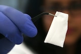 A doctor holds a "bioconstruct" that anchors stem cells to the vaginal wall.