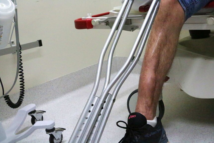 Two years on from the surgery, Mr Lichter's leg is holding up.