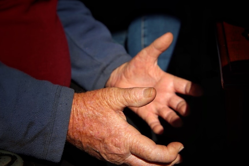 Close up of a man's hands with thumb facing out