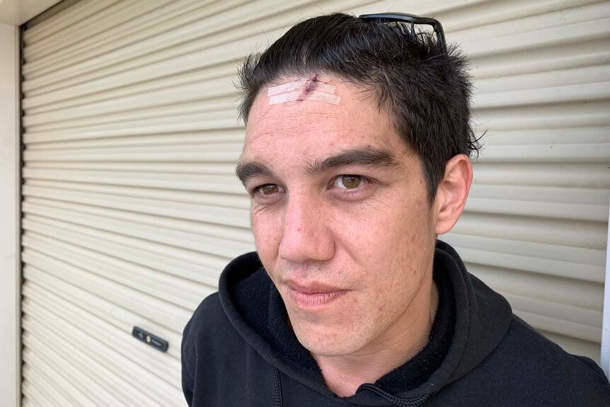 Headshot of Bobby Cook with a injury to his forehead, standing outside his garage door.