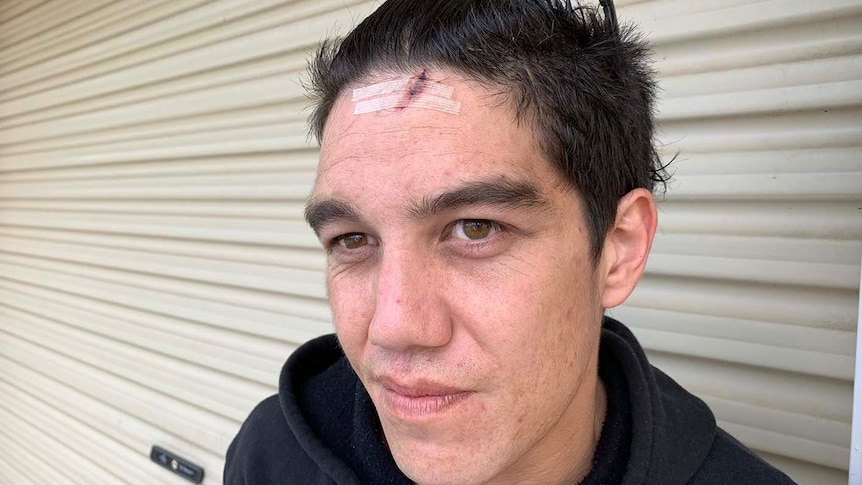 Headshot of Bobby Cook with a injury to his forehead, standing outside his garage door.