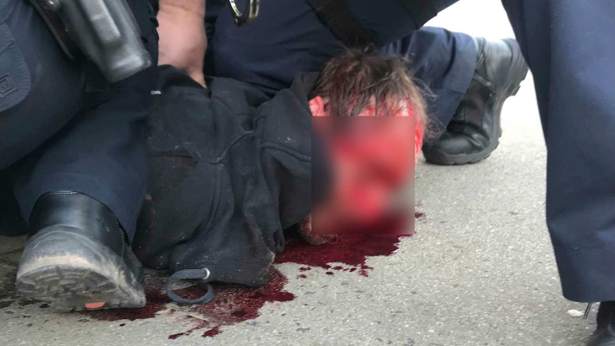 A man with blood on his face is handcuffed by police.