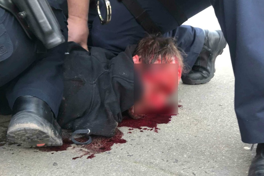 A man with blood on his face is handcuffed by police.