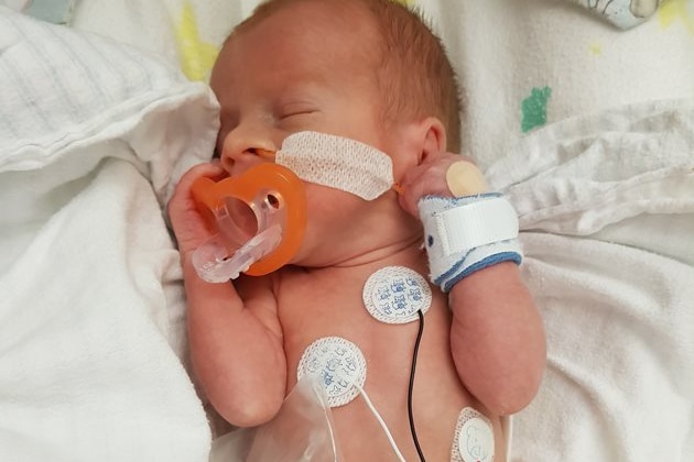 Tiny sick baby with tubes and medical paraphernalia over his little body