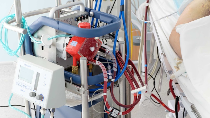 An ECMO machine connected to a patient in an ICU.