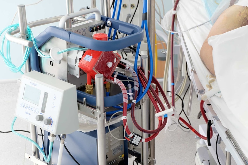 An ECMO machine connected to a patient in an ICU.