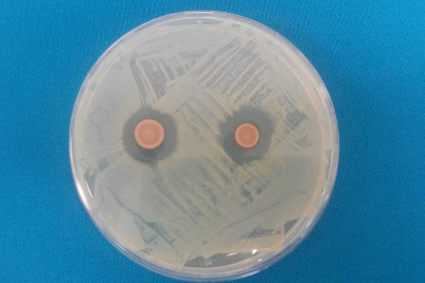Petri dish showing super bug as orange circle with a clear ring around it where the bacteria was killed.