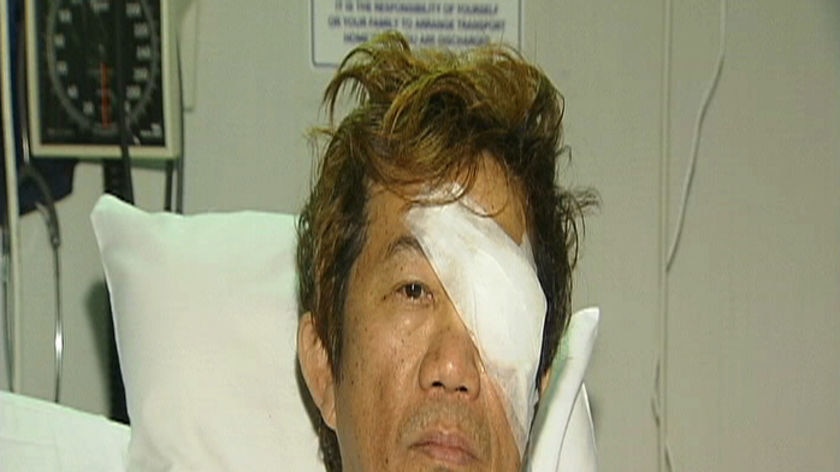 Gerard Sin was attacked with a concrete block in Perth's south-east.