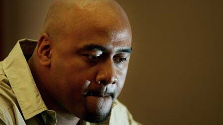 Lomu may have to cope with ongoing health problems from nephrotic syndrome.