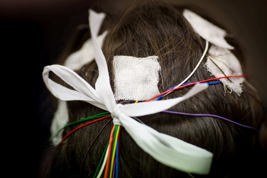 Pads are attached to Melina's scalp with conductive paste.