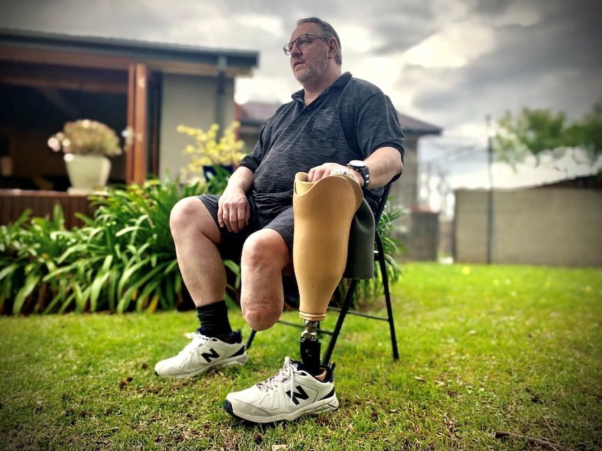 Greg Hislop seated, holding his prosthetic leg next to him.