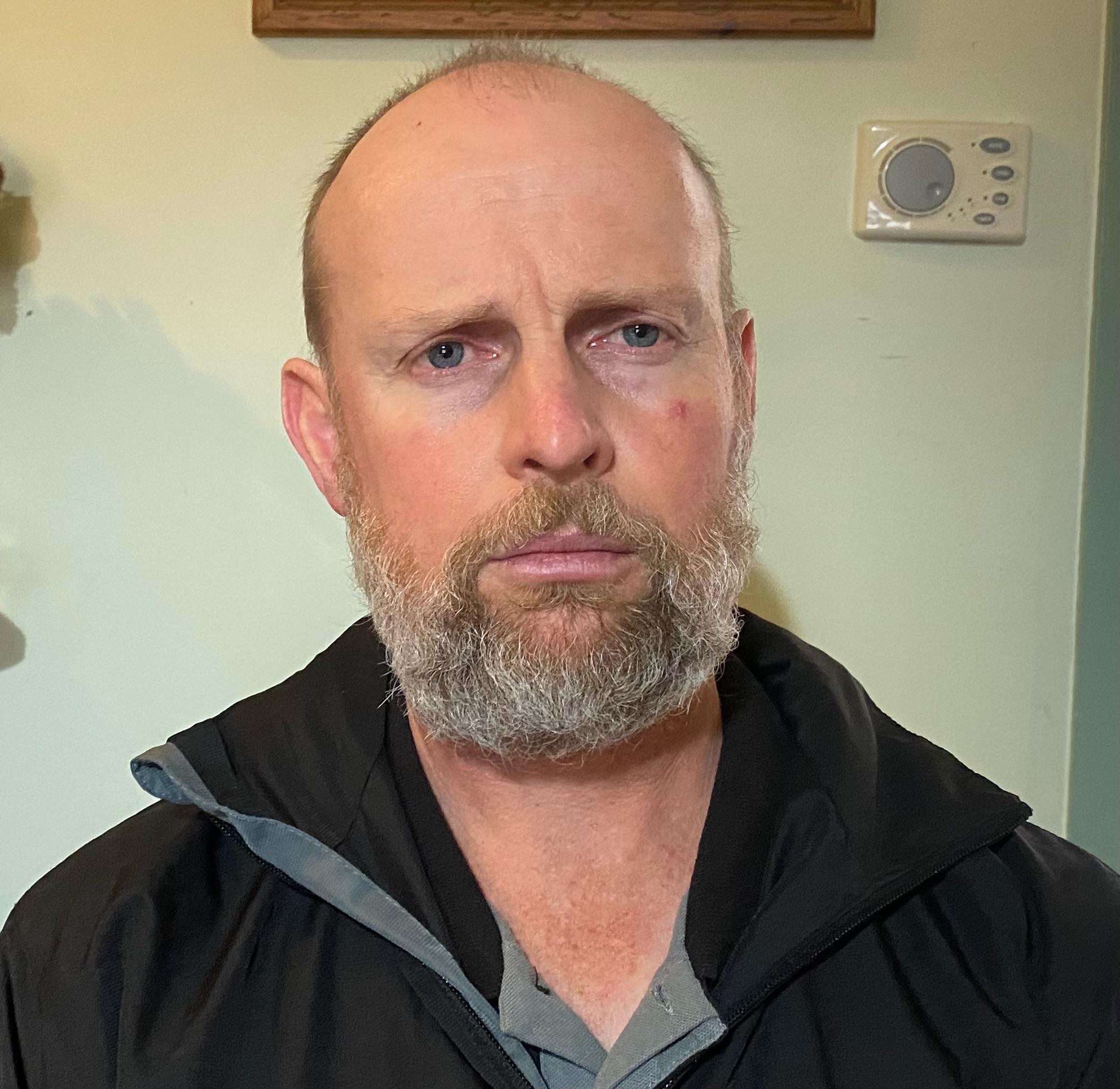 Man bald with beard in profile shot