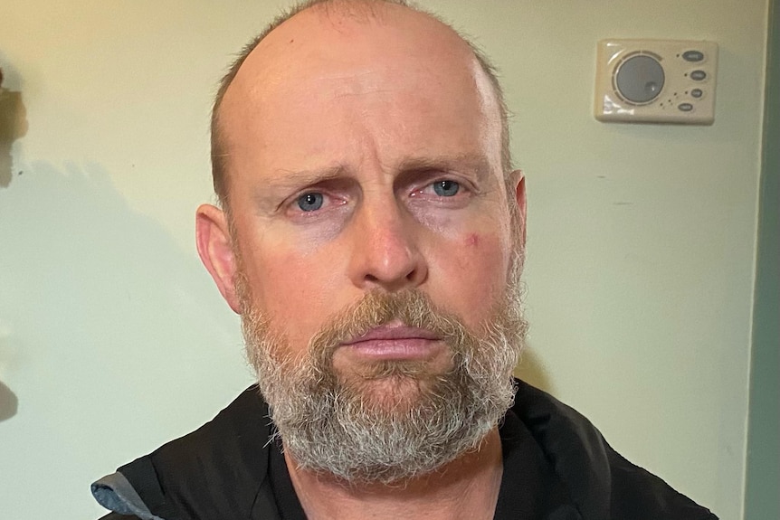 Man bald with beard in profile shot