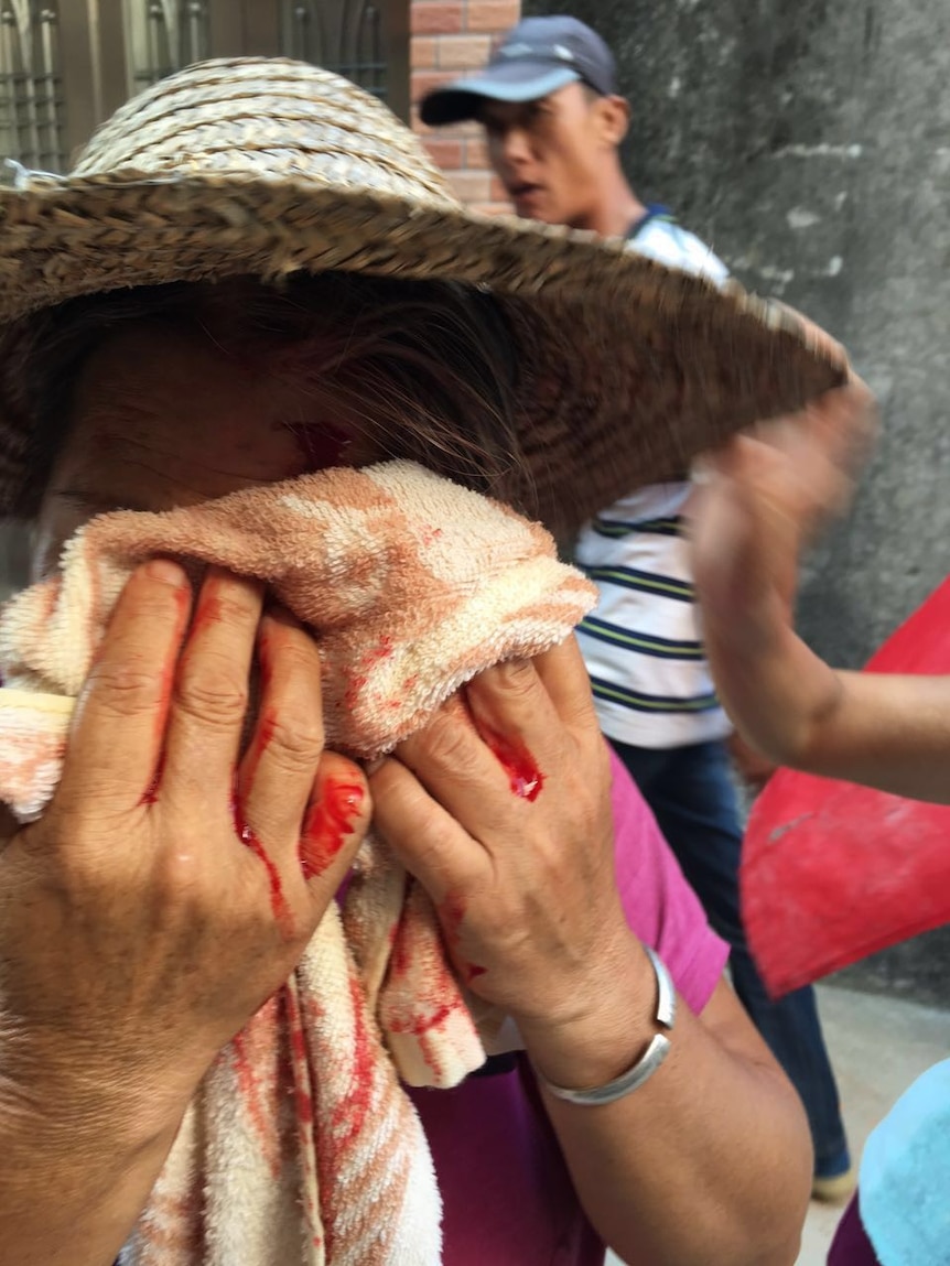 A Wukan protestor holds a towel to their bleeding face.