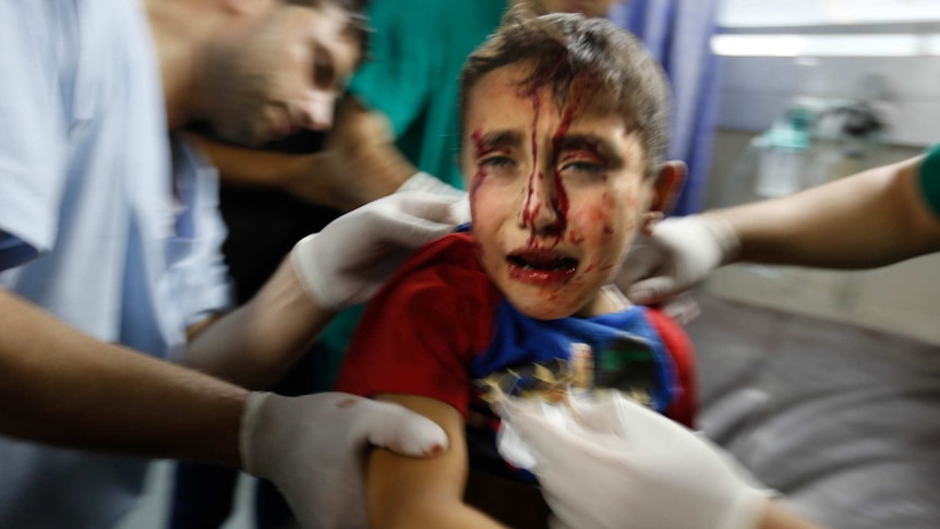Wounded boy in Gaza