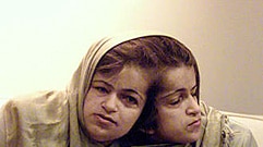 Iranian twin sisters