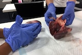 Researchers investigate pig hearts