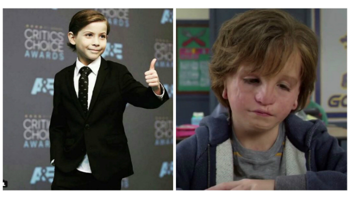 Boy actor before and after makeup which appeared as though he has a facial deformity.