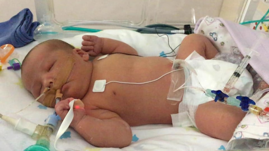 Harvey Northfield in his hospital cot with breathing tubes and heart monitor attached