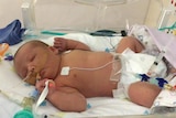 Harvey Northfield in his hospital cot with breathing tubes and heart monitor attached